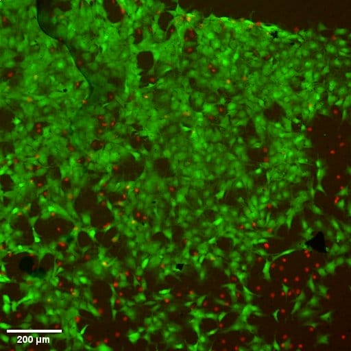 Confocal microscope image on bone like cell growth on Vibenite 350